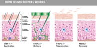 3D Micro Peel - PROFESSIONAL USE ONLY