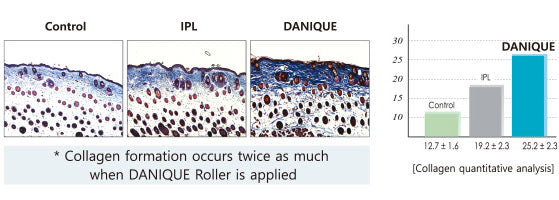 Micro Needle Roller